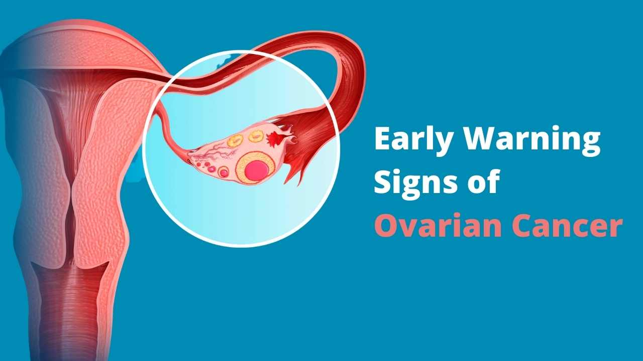 Early Warning Signs of Ovarian Cancer