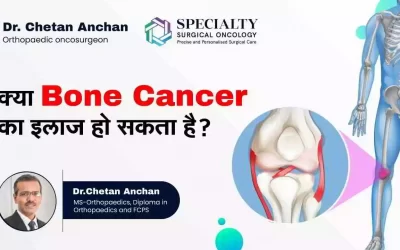 Treatment For Bone Cancer
