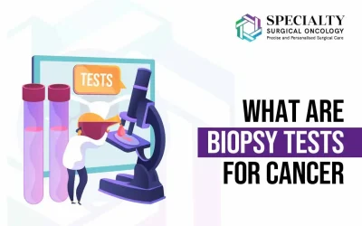 What is Biopsy Test For Cancer