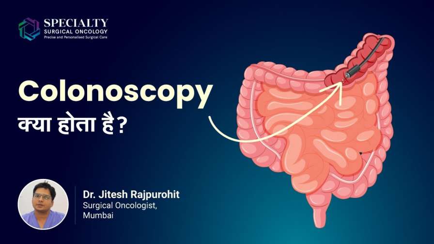What is Colonoscopy Test Dr. Jitesh Rajpurohit