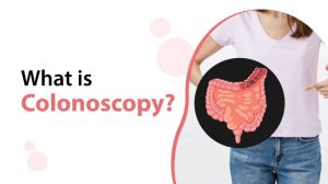 What is Colonoscopy?