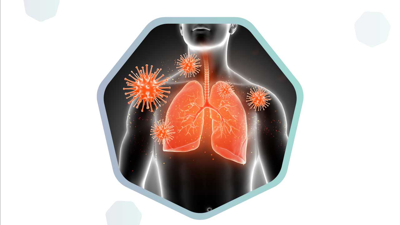 The symptoms of stage 1 lung cancer

