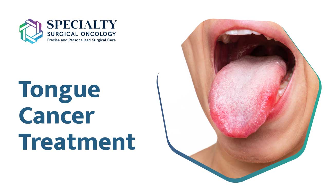 Tongue  Cancer treatment<br />
