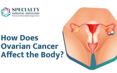 How Does Ovarian Cancer Affect the Body?