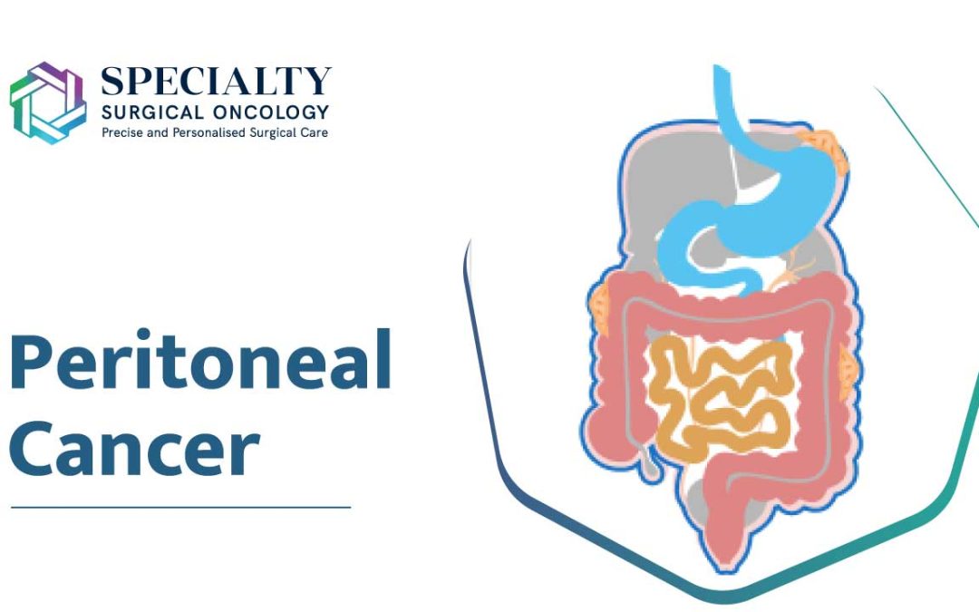 Survival Rates For Peritoneal Cancer