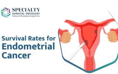 Survival Rates for Endometrial Cancer
