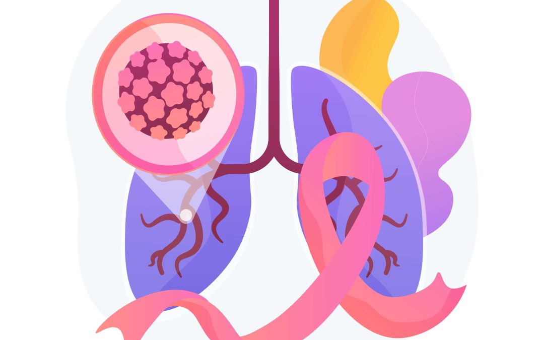 Early Detection and Diagnosis of Bile Duct Cancer