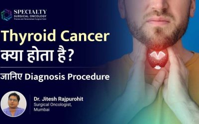 Thyroid Cancer: Types, Diagnosis & Treatment