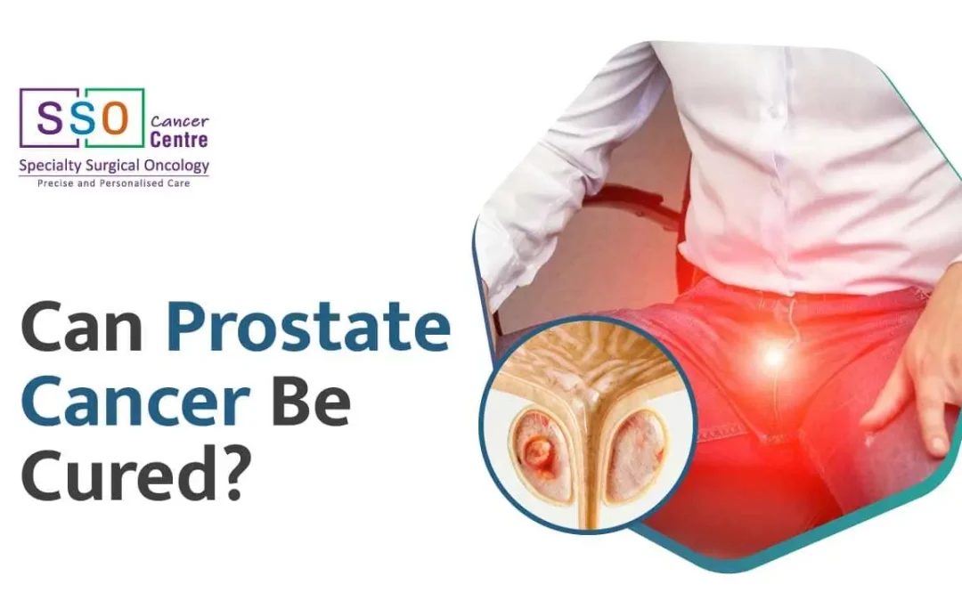Can Prostate Cancer Be Cured?  Treatment and Prognosis
