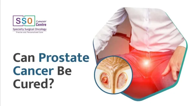 Can Prostate Cancer Be Cured? Treatment and Prognosis