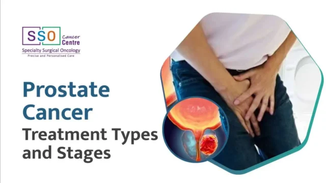 Prostate Cancer Treatment: Types, Options, and Side Effects