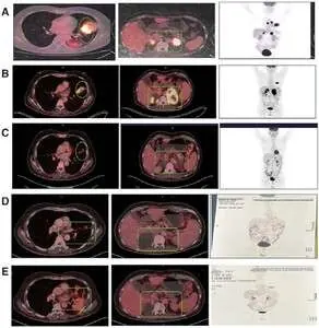 Journal of Immunotherapy and Precision Oncology — figure / cover