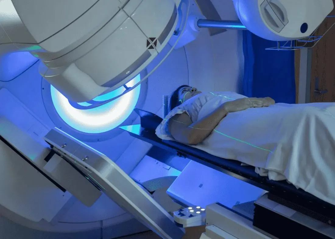 Patient lying on a treatment couch beneath a linear accelerator during radiotherapy