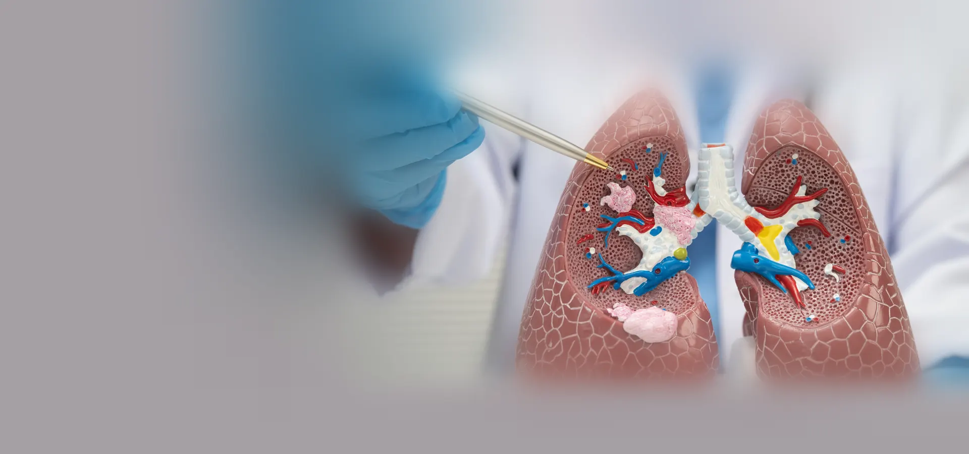 High-resolution thoracic oncology / lung cancer specialist image. Minimum 1920 × 900 px, JPG/PNG.